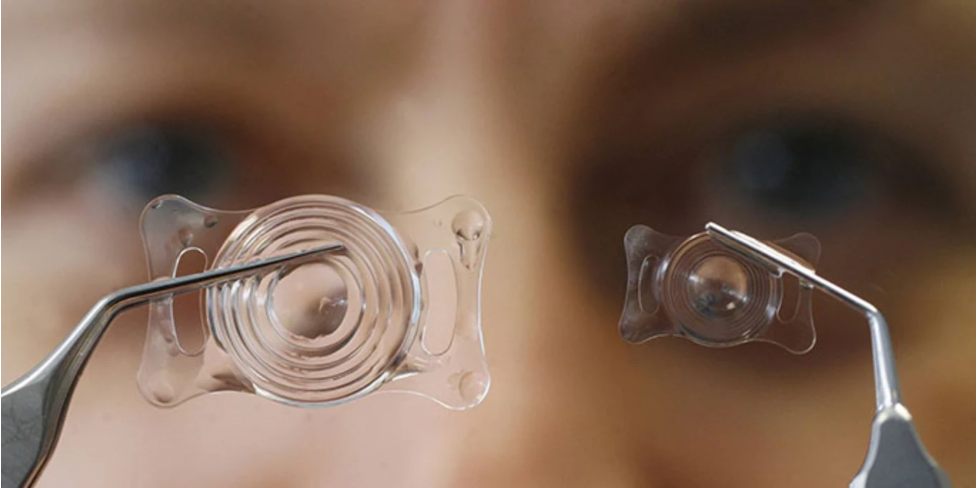 Заміна кришталика ока: важливість послідовності при операції та вибір правильної штучної лінзи ока