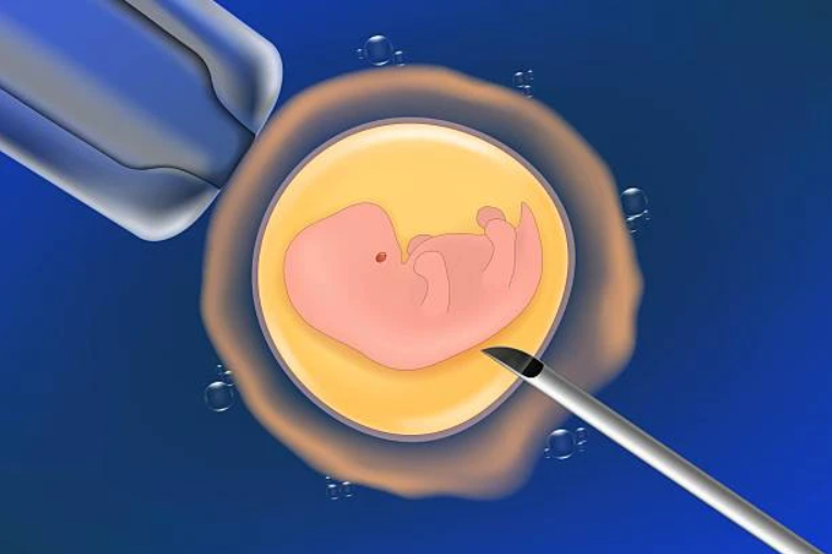 Роль современной диагностики в успехе бесплатного ЭКО ЭКО